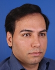 After Hair Transplant&nbsp;Front